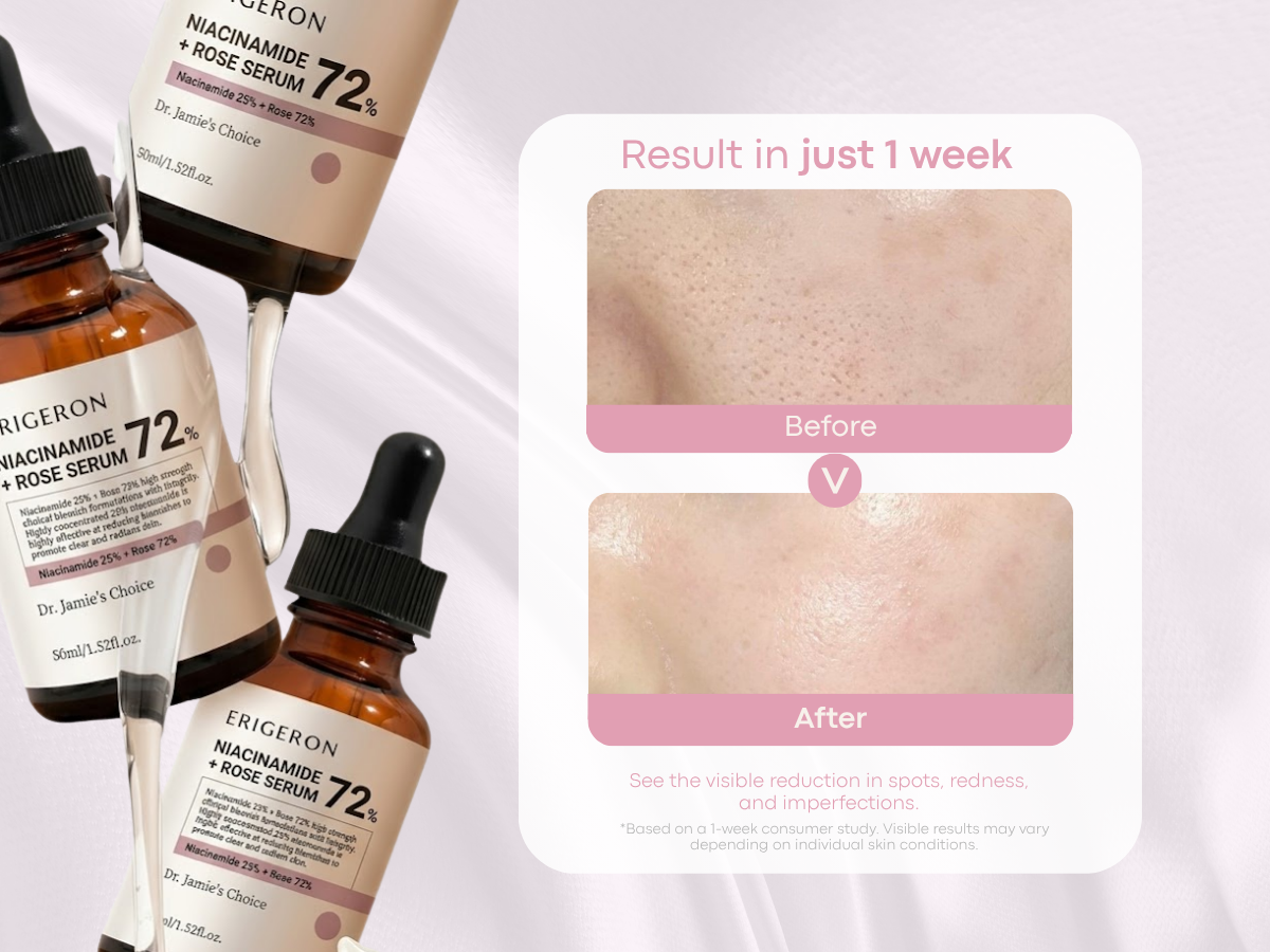 Niacinamide 25% + Rose 72% Serum - High Strength Clinical Blemish Care