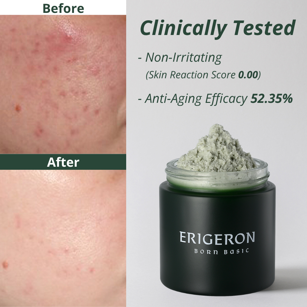 Heartleaf Package Set