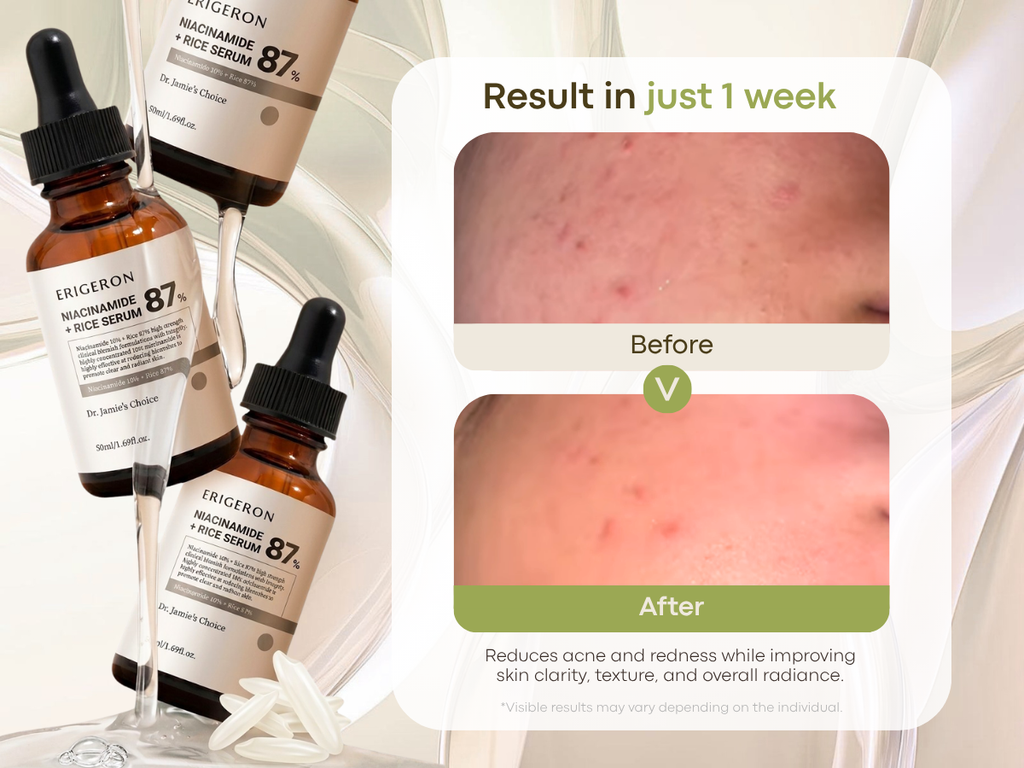 Niacinamide 20% & 10% Serum Bundle