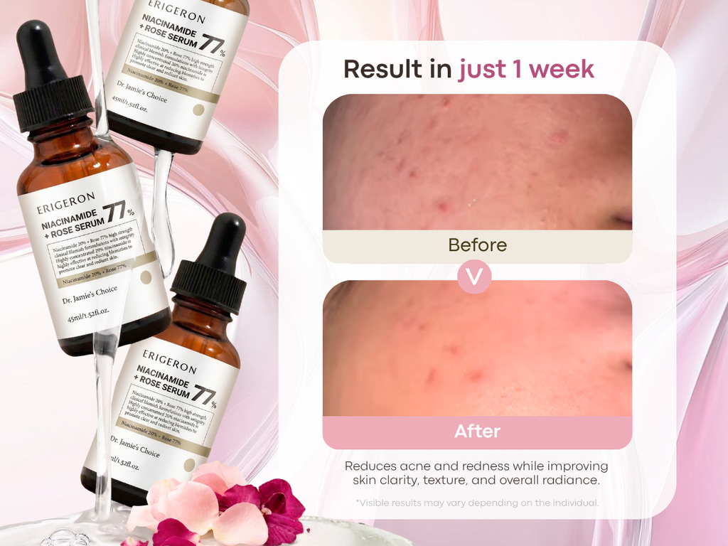 Niacinamide 77% Rose Serum
