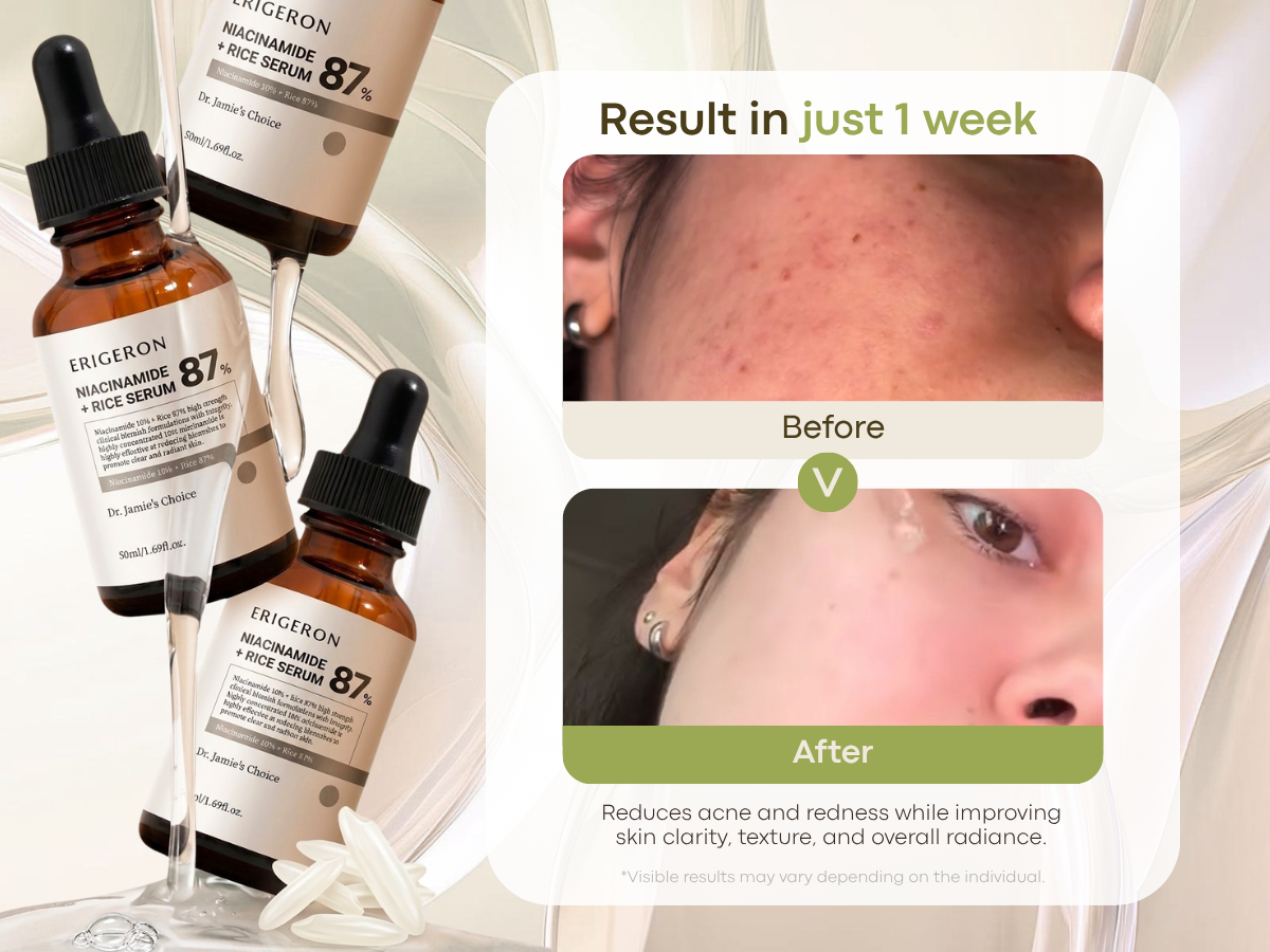 Niacinamide 87% Rice Serum